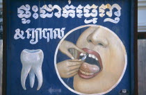 Dentists sign depicting an injection into a persons gums next to a single tooth