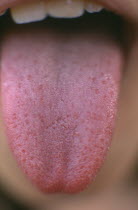 Close view of childs tongue showing taste buds.