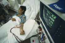 Woman lying in a bed with tubes running from her arm and monitor in the foreground