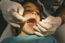 Dentist examining child with mouth wide open