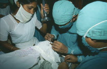 Orbis Ophthalmologist operates on patient at a cataract camp in Calcutta
