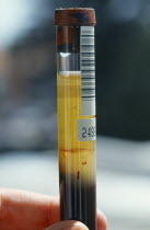 Serum in test tube