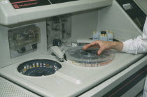 Serum Analyser with nurses hand on dial