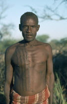 Portrait of Karamojong Mathenico clan warrior.  Scarification indicates the number of enemies killed. Pastoral tribe of the Plains Nilotes group related to the Masi