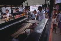 Karen refugee recieving medical attention watched by a crowd of children