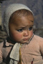 Himalayan baby looking unhappy