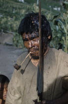 Victim after a ritual bow fight in which aim is to hit the opponent s head. Blood  now dried  has streamed from wound. Clutches his hard   macana  wood bow and quiver of arrows  smoking a clay pipeIn...