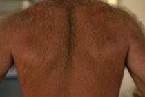 Detail of hairy back.
