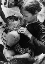 Badly burned Vietnamese baby caught in bursting napalm bomb between US Marines and North Vietnamese taking water from a soldier s water bottle on his mother s knee.victims wounded innocence war warfa...