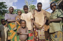 Burundi, Kirundo, A family beside the road living in poverty, child with obvious worms.