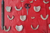 India, West Bengal, Asansol, Display of dentures and dental equipment by a street dentist.