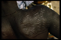 NIGERIA, Body Decoration, Close up view of body scarification on back  shoulder and arm of a Shuwa woman.